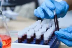 Exame de sangue capaz de diagnosticar o Alzheimer chega ao Brasil