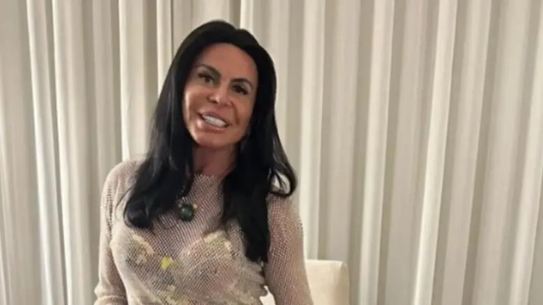 Gretchen mostra ao vivo resultado de transplante capilar após diagnóstico de alopecia; veja antes e depois Gretchen mostra resultado de transplante capilar após diagnóstico de alopecia e comemora: “Estou linda de novo”; assista! (Foto: Reprodução/ Instagram)
