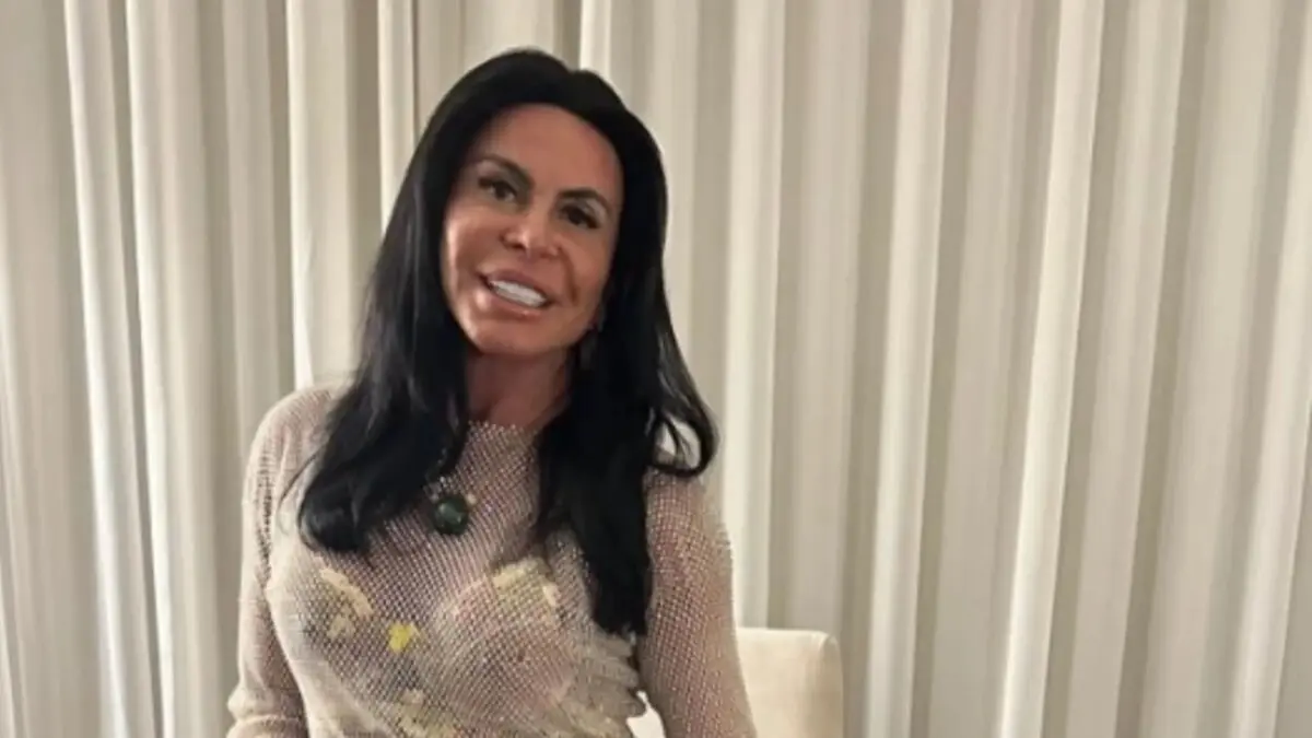 Gretchen mostra ao vivo resultado de transplante capilar após diagnóstico de alopecia; veja antes e depois Gretchen mostra resultado de transplante capilar após diagnóstico de alopecia e comemora: “Estou linda de novo”; assista! (Foto: Reprodução/ Instagram)